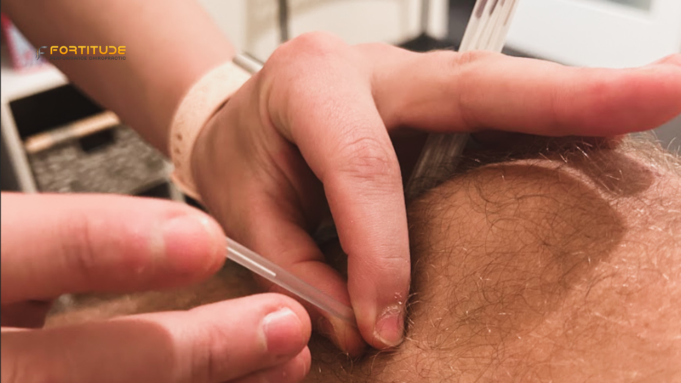 Dr. Molly applying dry needling to athlete’s leg to relieve tightness and improve mobility in Scottsdale