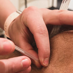 Dr. Molly applying dry needling to athlete’s leg to relieve tightness and improve mobility in Scottsdale